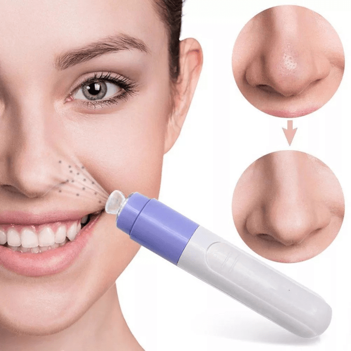 vacuum device for facial renewal